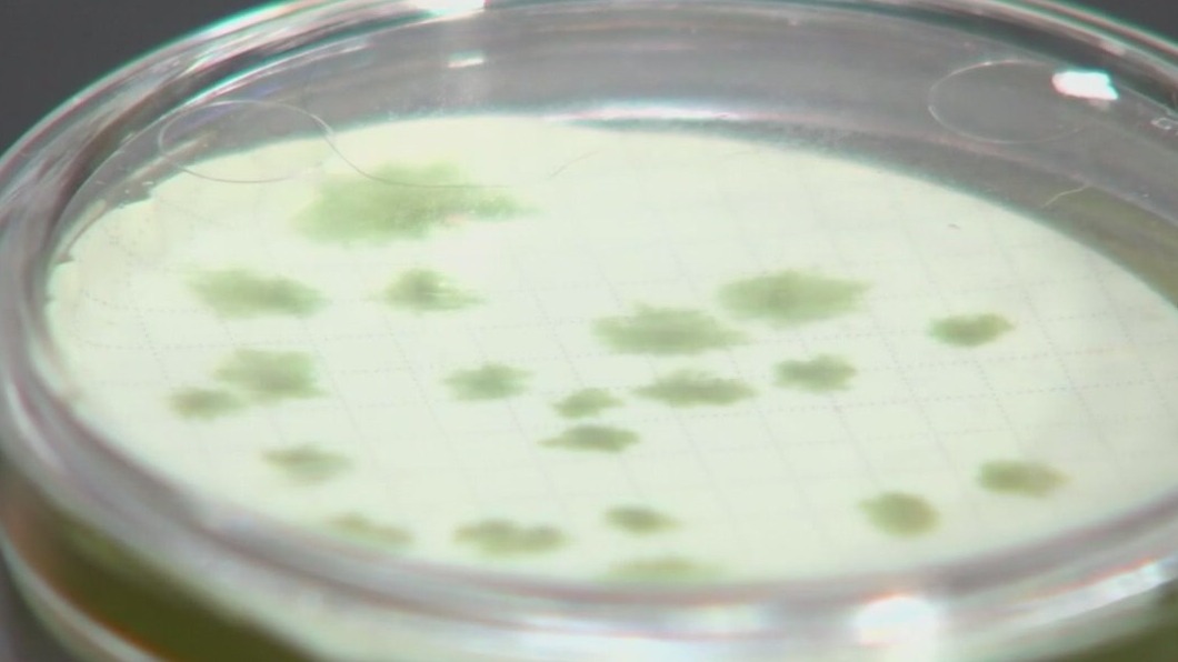 Warm water helping flesh-eating bacteria grow